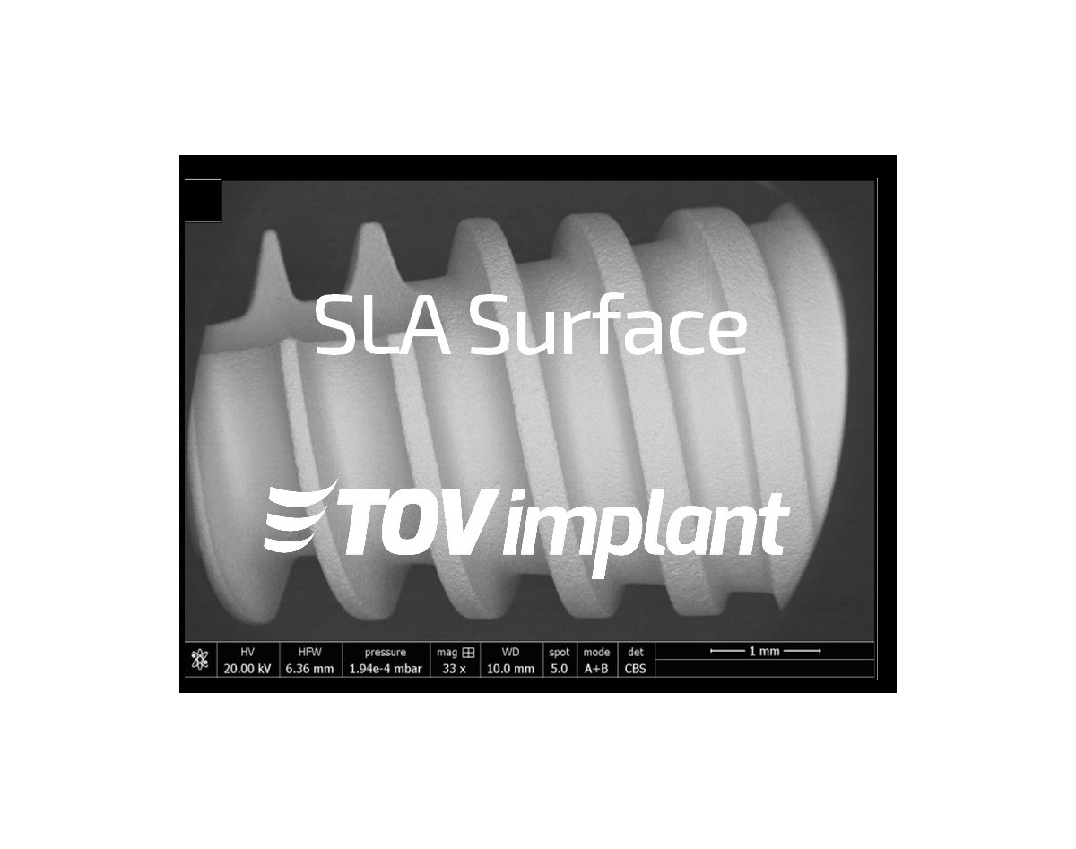 Trattamento di Superficie SLA degli Impianti: Una Soluzione di Eccellenza di TOV Implant